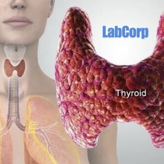 Thyroid test